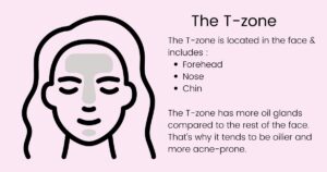 T-zone and oily skin in pregnancy